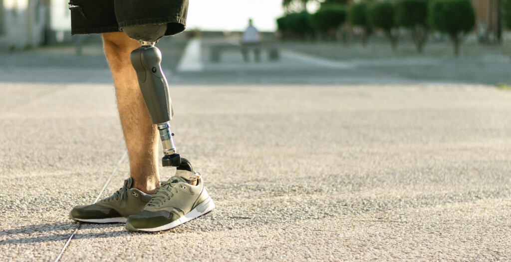 Low Angle View At Disabled Young Man With Prosthetic Leg Walking